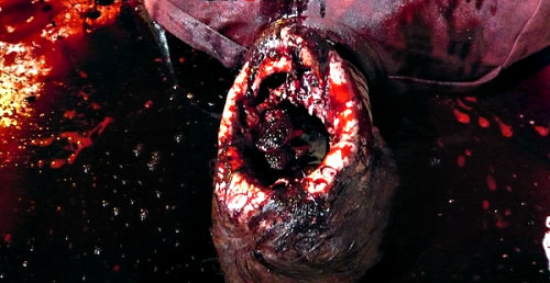 autopsy