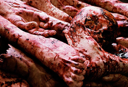 Autopsy