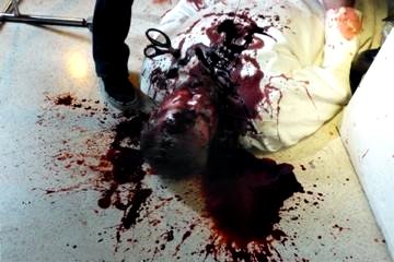 Autopsy