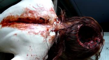 Autopsy