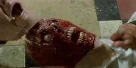 Braindead