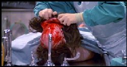 Re-animator