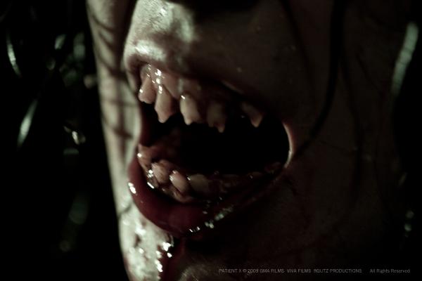 Patient X