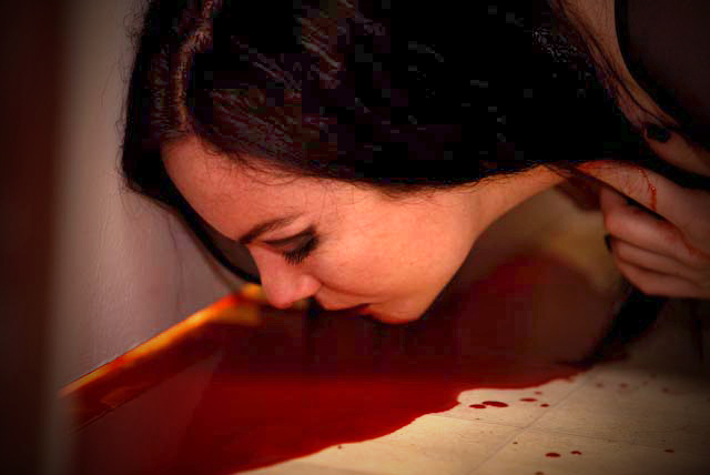 Wound