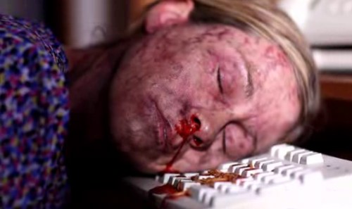 Wound