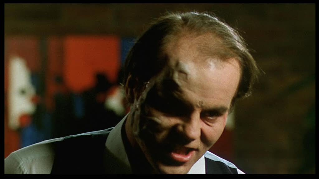 Scanners