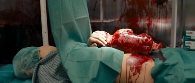 De nuevo, un insufrible remake hizo que perdiera mi tiempo. 'Está vivo' (2009) de Josef Rusnak, despertó en mí una mínima esperanza de ver al menos algo decente, que volvió a hacerme caer en la trampa de las innecesarias revisiones. La cinta original, dirigida por Larry Cohen en 1974, una de las pequeñas joyas de esa década, ofrecía un punto de vista muy diferente. Así de entrada, y teniendo frescas ambas versiones, decir que hay una diferencia abismal entre una cinta y otra. Mientras la original trata el tema más profundamente y sin necesidad de mostrar grandes cantidades de hemoglobina, centrándose más en el drama, el misterio y la controversia que despierta en la sociedad el terrible suceso inicial, la cinta que nos propone Josef Rusnak, es todo lo contrario, y solo va a mostrar lo que vulgarmente podríamos llamar como 'chicha', es decir, una sucesión de secuencias donde la sangre sin sentido toma protagonismo.  Si lo acertado en la cinta original de Larry Cohen era el enfoque que se daba a la historia, mostrando toda la repercusión que despertaba el suceso alrededor de la familia protagonista, en la revisión de 2009, pese a contar con un guión en el que participa el propio Cohen, todo queda simplificado a la locura o trauma transitorio que sufre la madre tras el suceso. Un suceso que ya de entrada, muestra que las cosas van a ir por un camino muy diferente a la cinta original, cambiando el intenso misterio por insulsas secuencias sangrientas, y la controversia social, por un problema limitado a la propia pareja protagonista, que a diferencia de la cinta original, está interpretada por jóvenes actores, dejando claro a quien va dirigida la película.  Pero si hay algo realmente decepcionante en la película de Josef Rusnak, es el bebé asesino, ese que tiene que guiar la acción en la película. En esta versión se muestra a un bebe asesino tierno y dulce, sin ningún tipo de malformación, hecho que hace que las sangrientas escenas donde dicho bebe mata a sus víctimas, sean poco creíbles, dejando claro la finalidad de la película, la cual se construye a base de despropósitos que solo pueden mostrar una cacería con pocas pretensiones. Además, si le quitamos, como aquí, la gracia de ir conociendo poco a poco la fisonomía del bebé, que en teoría a de ser un ser monstruoso, acabamos por lapidar, las buenas intenciones que proponía la cinta dirigida por Larry Cohen.  En definitiva, un fiasco de remake como era de esperar, que no logra estar a la altura de la cinta original en ningún momento, esa que tan solo cree en ella misma cuando muestra sangre y la absurda cacería del bebé. La culpa no son los guiones vacíos y sin fundamento que proliferan hoy en día, sino el absurdo propósito de realizar la revisión de antiguas cintas de cierto nivel, para transformarlas en un producto que solo consigue destrozar la historia original. La reciente película escrita y dirigida por Paul Solet 'Grace' (2009), toca un tema similar, tratando sobre la obsesión y la enfermedad mental que sufre una madre tras la pérdida y resurrección de su bebé, una historia de enorme calidad que puede presumir de mostrar algo nuevo y convincente.